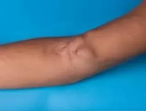 Diabetes Specialist Doctor Rajahmundry