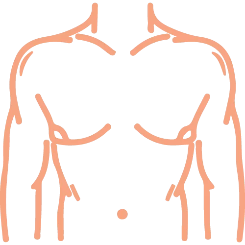 Laparoscopic Appendix Surgery Rajahmundry