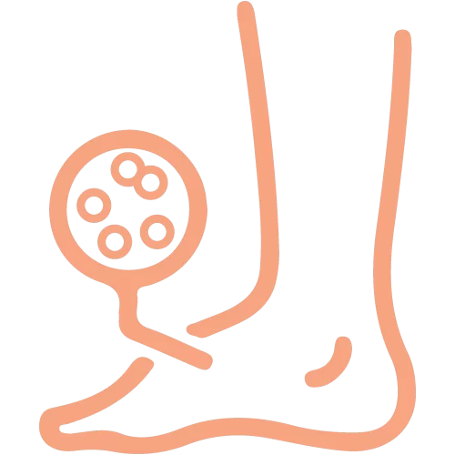 Appendicitis Surgery Rajahmundry