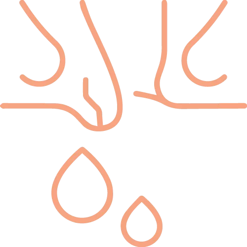 Laparoscopic Gallstone Surgery Rajahmundry