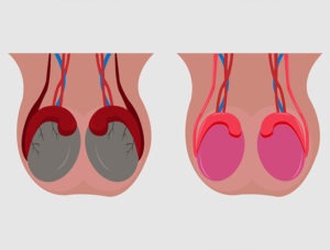 Thyroid Surgery Hospital Rajahmundry
