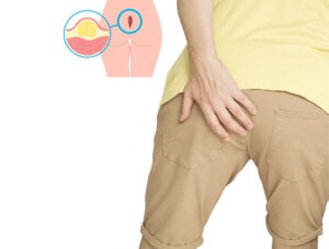 Appendix Specialist Doctor Rajahmundry