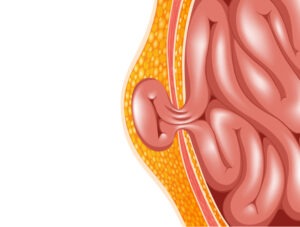 Advanced Laparoscopic Surgery Rajahmundry