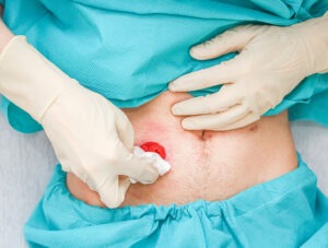 Hysterectomy Specialist Doctor Rajahmundry