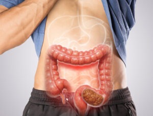 Hydrocele Surgery Hospital Rajahmundry